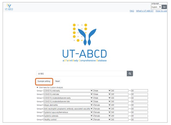 example filter setting en